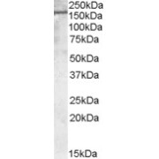 abx431867 (1 µg/ml) staining of Human Kisney lysate (35 µg protein in RIPA buffer). Primary incubation was 1 hour. Detected by chemiluminescence.