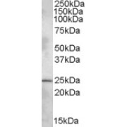 abx431870 (1 µg/ml) staining of Rat Brain lysate (35 µg protein in RIPA buffer). Primary incubation was 1 hour. Detected by chemiluminescence.