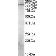 abx431876 (1 µg/ml) staining of Human Temporal Cortex lysate (35 µg protein in RIPA buffer). Primary incubation was 1 hour. Detected by chemiluminescence.