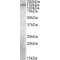 Phosphatidylinositol 3,4,5-Trisphosphate-Dependent Rac Exchanger 1 Protein (PREX1) Antibody