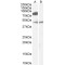 Palmitoyltransferase ZDHHC8 (ZDHHC8) Antibody