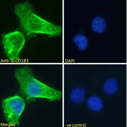 Solute Carrier Organic Anion Transporter Family Member 1B3 (SLCO1B3) Antibody