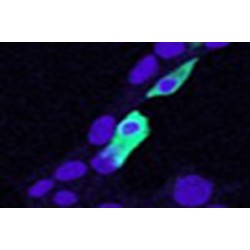 Chloride Intracellular Channel Protein 4 (CLIC4) Antibody