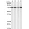 Activating Transcription Factor 6 (ATF6) Antibody