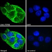 Immunofluorescence analysis of paraformaldehyde fixed A431 cells, permeabilized with 0.15% Triton. Primary incubation 1hr (10 µg/ml) followed by Alexa Fluor 488 secondary antibody (2 µg/ml), showing membrane and vesicle staining. The nuclear stain is DAPI (blue). Negative control: Unimmunized goat IgG (10 µg/ml) followed by Alexa Fluor 488 secondary antibody (2 µg/ml).