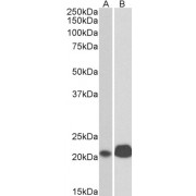 abx431910 (0.1 µg/ml) staining of Jurkat (A) and Molt4 (B) lysates (35 µg protein in RIPA buffer). Primary incubation was 1 hour. Detected by chemiluminescence.