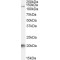 HIV TAT Specific Factor 1 (HTATSF1) Antibody