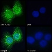 Immunofluorescence analysis of paraformaldehyde fixed A431 cells, permeabilized with 0.15% Triton. Primary incubation 1hr (10 µg/ml) followed by AF488 secondary antibody (2 µg/ml), showing nuclear and cytoplasmic staining. The nuclear stain is DAPI (blue). Negative control: Unimmunized goat IgG (10 µg/ml) followed by AF488 secondary antibody (2 µg/ml).