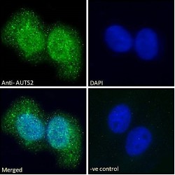 Autism Susceptibility Gene 2 Protein (AUTS2) Antibody