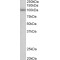 SID1 Transmembrane Family Member 1 (SIDT1) Antibody