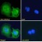 Arylacetamide Deacetylase-Like 1 (AADACL1) Antibody