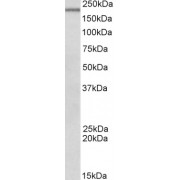 abx431927 (0.5 µg/ml) staining of Mouse Spleen lysate (35 µg protein in RIPA buffer). Primary incubation was 1 hour. Detected by chemiluminescence.