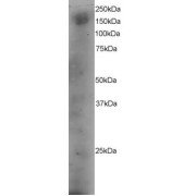 abx431929 staining (4 µg/ml) of A431 lysate (RIPA buffer, 35 µg total protein per lane). Primary incubated for 12 hour. Detected by western blot using chemiluminescence.