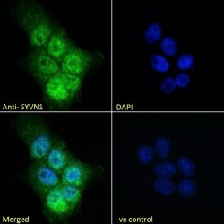 E3 Ubiquitin-Protein Ligase Synoviolin (SYVN1) Antibody