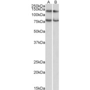 abx431935 (0.3 µg/ml) staining of Jurkat (A) and HeLa (B) lysates (35 µg protein in RIPA buffer). Primary incubation was 1 hour. Detected by chemiluminescence.