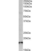 abx431950 (0.3g/ml) staining of Rat Pancreas lysate (35 µg protein in RIPA buffer). Primary incubation was 1 hour. Detected by chemiluminescence.