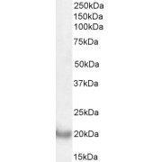 Western blot analysis of Human Liver lysate (35 µg protein in RIPA buffer) using DCTN3 antibody (0.1 µg/ml).