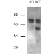 abx431990 (1 µg/ml) staining of Mouse Brain and KO Mouse Brain lysates (35 µg protein in RIPA buffer). Primary incubation was 1 hour. Detected by chemiluminescence.