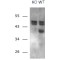 Calcipressin-1 (RCAN1) Antibody