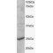 Cytochrome B561 Family Member D2 (CYB561D2) Antibody