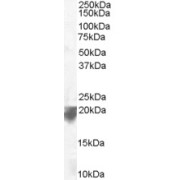 abx432009 staining (0.1 µg/ml) of Human Spleen lysate (RIPA buffer, 35 µg total protein per lane). Detected by chemiluminescence.