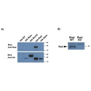 A) abx432011 (0.5 µg/ml) staining of HEK293 lysates overexpressing several HA-tagged Mouse GTPases, including Rrad (10µg protein in RIPA buffer) and compared with an HA-specific antibody. B) abx432011 (0.5 µg/ml) staining of WT and KO lysates of Mouse Heart (100µg protein in RIPA buffer). Primary incubation was 1 hour. Detected by chemiluminescence.