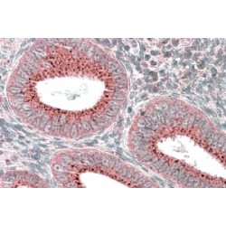 Sorting Nexin 1 (SNX1) Antibody