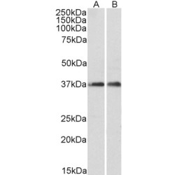 Actin-Related Protein 2/3 Complex Subunit 1A (ARPC1A) Antibody