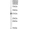 Tumor-Associated Calcium Signal Transducer 2 (TROP2) Antibody