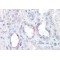 Ammonium Transporter Rh Type B (RHBG) Antibody