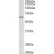 Hypermethylated In Cancer 2 Protein (HIC2) Antibody