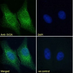 Synaptic Vesicle Glycoprotein 2A (SV2A) Antibody