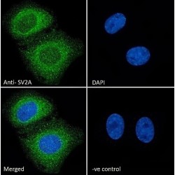 Synaptic Vesicle Glycoprotein 2A (SV2A) Antibody