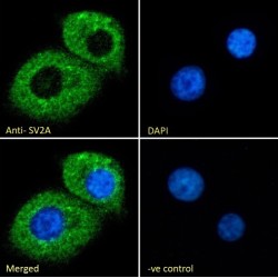 Synaptic Vesicle Glycoprotein 2A (SV2A) Antibody