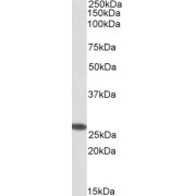 abx432065 (0.3 µg/ml) staining of Human Placenta lysate (35 µg protein in RIPA buffer). Primary incubation was 1 hour. Detected by chemiluminescence.