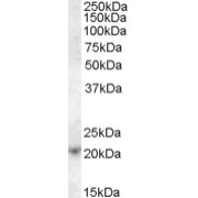 abx432072 (1 µg/ml) staining of Jurkat cell lysate (35 µg protein in RIPA buffer). Primary incubation was 1 hour. Detected by chemiluminescence.