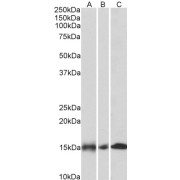 abx432073 (0.1 µg/ml) staining of Pig Heart lysate (35 µg protein in RIPA buffer). Detected by chemiluminescence.