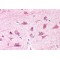 Biorientation of Chromosomes In Cell Division Protein 1-Like 1 (BOD1L) Antibody