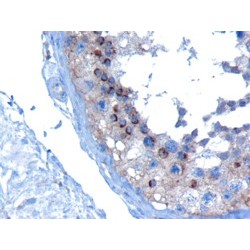 Vacuolar Protein Sorting-Associated Protein 28 Homolog (VPS28) Antibody