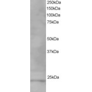 abx432086 staining (1 µg/ml) of Human Testis lysate (RIPA buffer, 35 µg total protein per lane). Primary incubated for 1 hour. Detected by chemiluminescence.