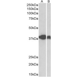 Isocitrate Dehydrogenase [NAD] Subunit Alpha, Mitochondrial (IDH3A) Antibody