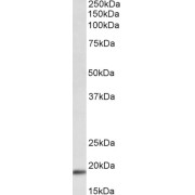 abx432109 (0.3 µg/ml) staining of Mouse Heart lysate (35 µg protein in RIPA buffer). Primary incubation was 1 hour. Detected by chemiluminescence.