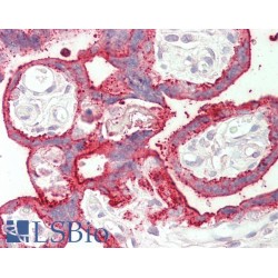 Succinate Dehydrogenase Assembly Factor 1, Mitochondrial (SDHAF1) Antibody