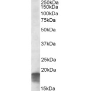 abx432117 (0.3 µg/ml) staining of Human Cerebellum lysate (35 µg protein in RIPA buffer). Primary incubation was 1 hour. Detected by chemiluminescence.