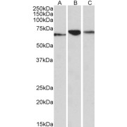 abx432126 (0.1 µg/ml) staining of Human (A), Mouse (B) and Rat (C) Pancreas lysates (35 µg protein in RIPA buffer). Primary incubation was 1 hour. Detected by chemiluminescence.