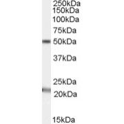 abx432131 (1 µg/ml) staining of Human Brain (Substantia nigra) lysate (35 µg protein in RIPA buffer). Primary incubation was 1 hour. Detected by chemiluminescence.