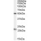 Acylglycerol Kinase (AGK) Antibody