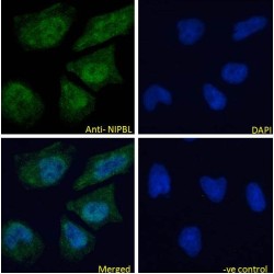 NIPBL, Cohesin Loading Factor (NIPBL) Antibody