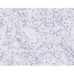 NIPBL, Cohesin Loading Factor (NIPBL) Antibody