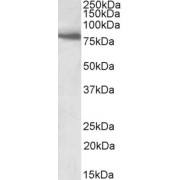 abx432143 (1 µg/ml) staining of Human Skeletal Muscle lysate (35 µg protein in RIPA buffer). Primary incubation was 1 hour. Detected by chemiluminescence.